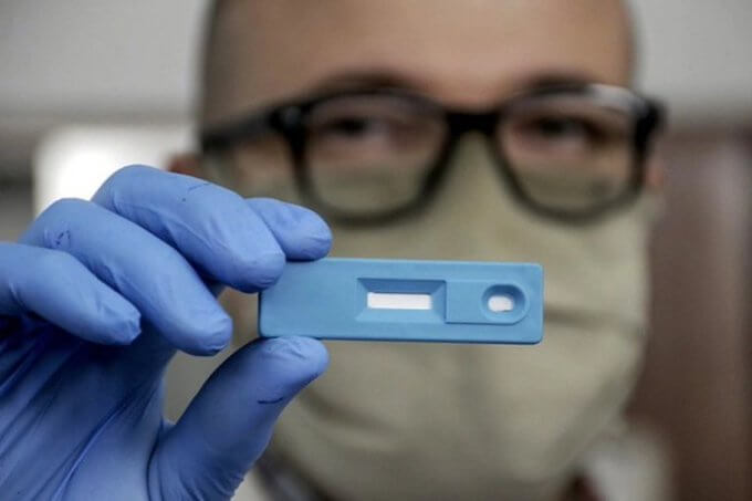 La ANMAT aprobó el primer test rápido serológico desarrollado en laboratorios de la UNLP