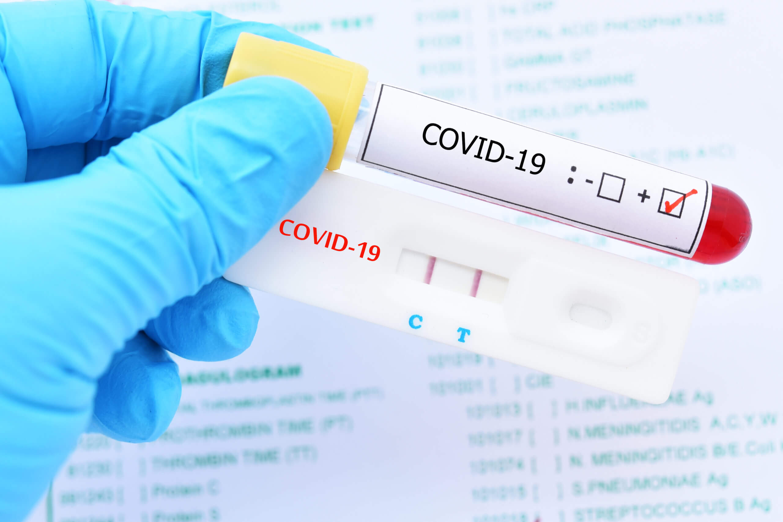 Por qué la Provincia prohibió la venta de test de COVID en farmacias