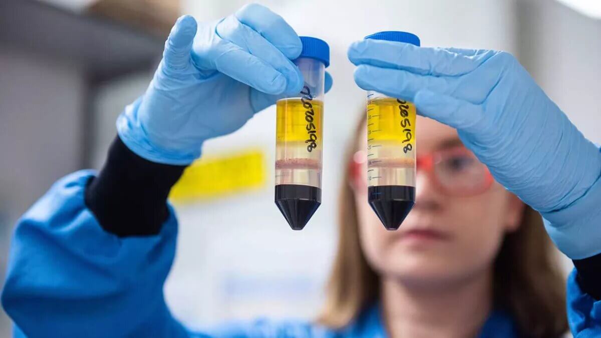 Coronavirus: la circulación de la variante de Manaos predomina en el Pais