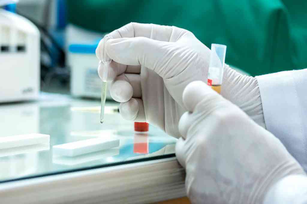 Rusia desarrollará para fines de 2021 test rápidos para detectar "cualquier virus"