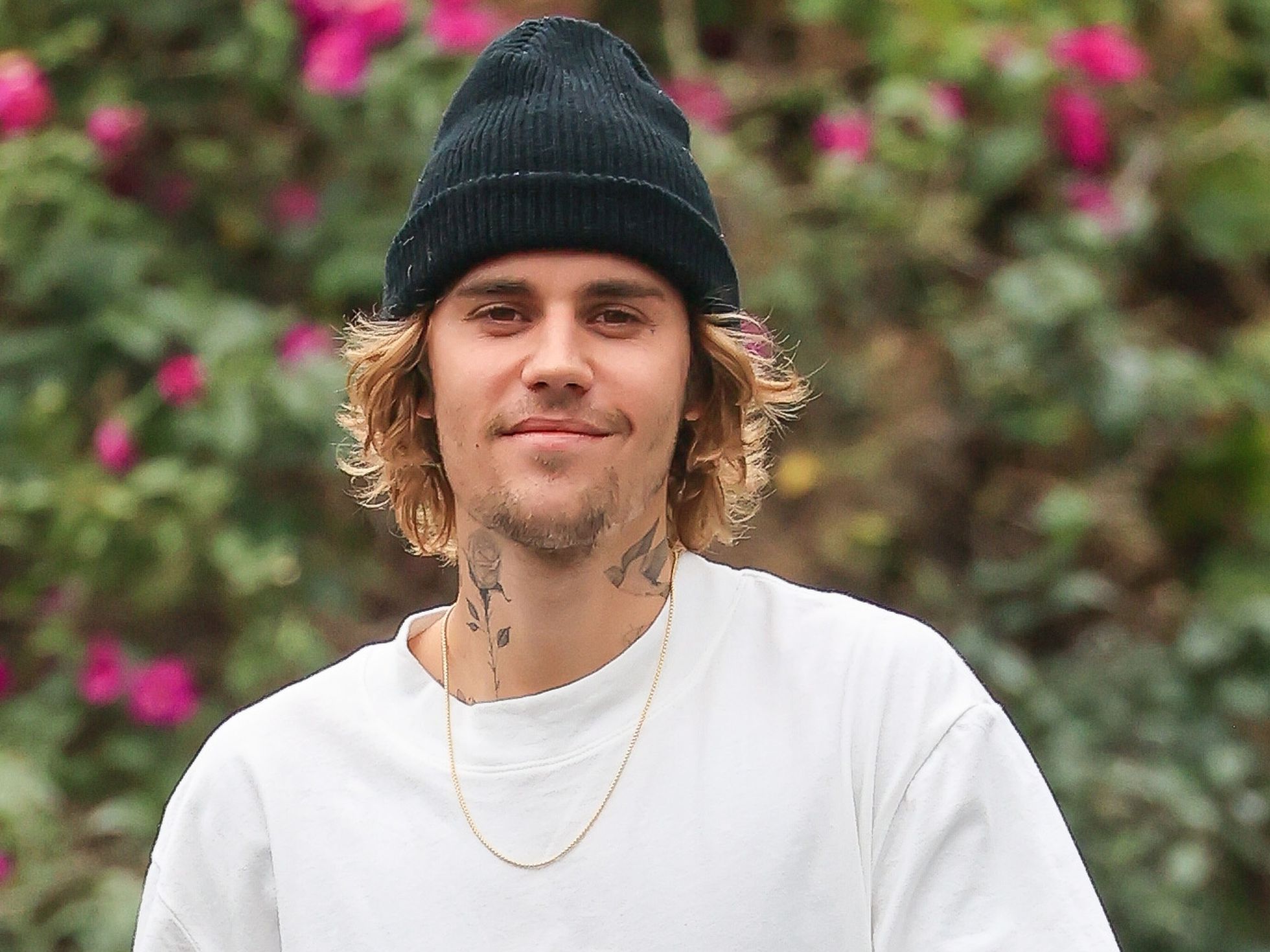 Justin Bieber canceló varios conciertos de su gira por una parálisis facial