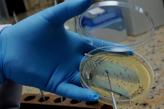 Detectan y contienen un brote de una bacteria que es resistente a todas las drogas en Argentina