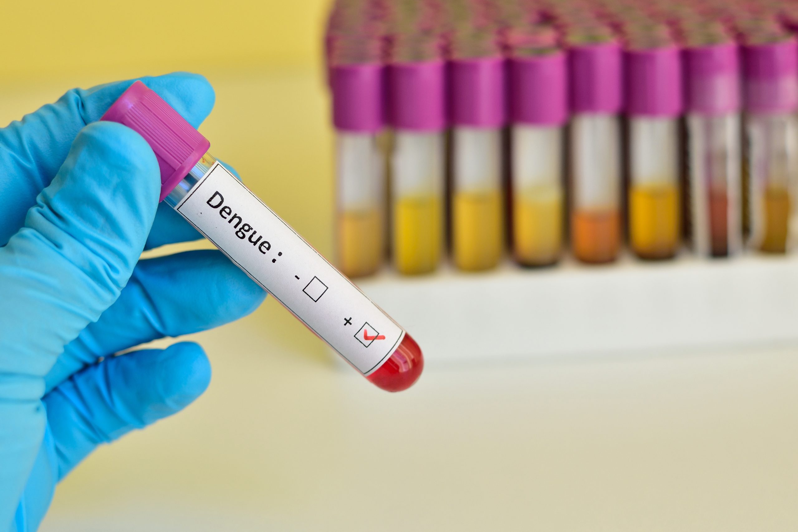 Alerta Epidemiológica: los casos de Dengue siguen en alza