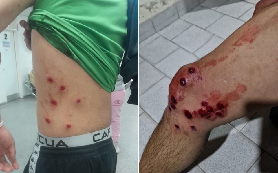 Incidentes en la Liga Amateur Platense: disturbios entre hinchas y represión policial