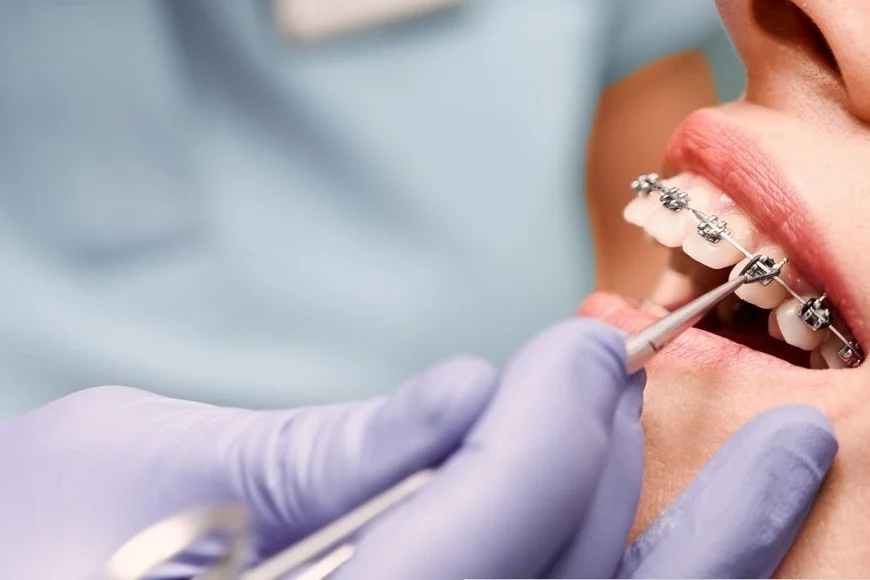 ANMAT prohíbe dos medicamentos y varios insumos odontológicos por falta de registros y riesgos para la salud - Punto Capital Noticias