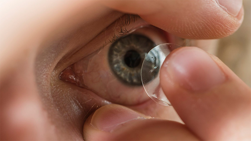 Alerta por lentes de contacto sin registro: Anmat prohibió la marca NOVMAS