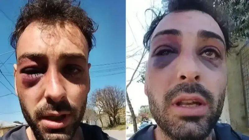 Un luthier platense denunció una brutal agresión policial